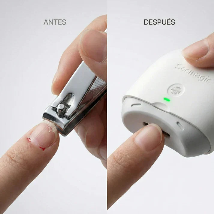 "Nails Master" - CortaUñas Automático de Alta Precisión